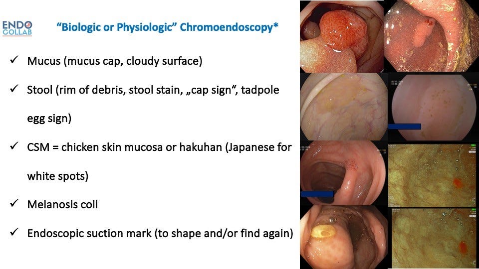 Natural or Biologic Chromoendoscopy for Detection of Colorectal Polyps –  EndoCollab