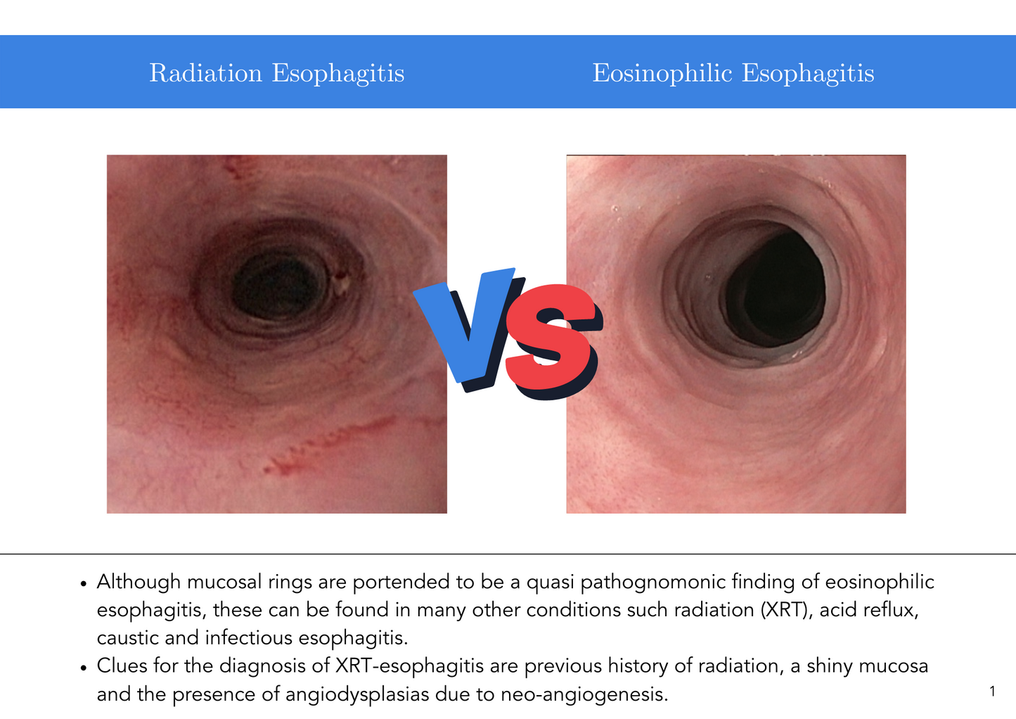 This vs That Digital Flashcards | EndoCollab