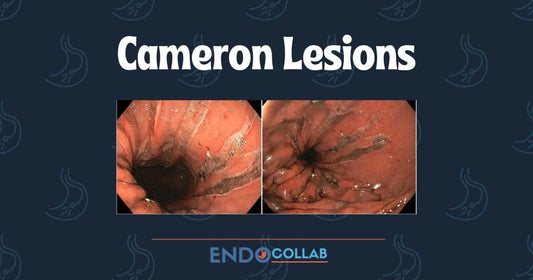 Gi Endoscopy Tips & Tricks – EndoCollab