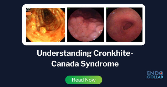 Understanding Cronkhite-Canada Syndrome