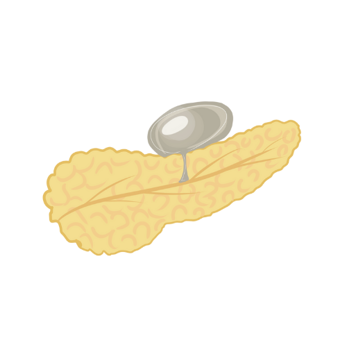 Endoscopic Drainage of Fluid Collections